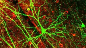 Brain and mind. Physical and psychological functions of the brain