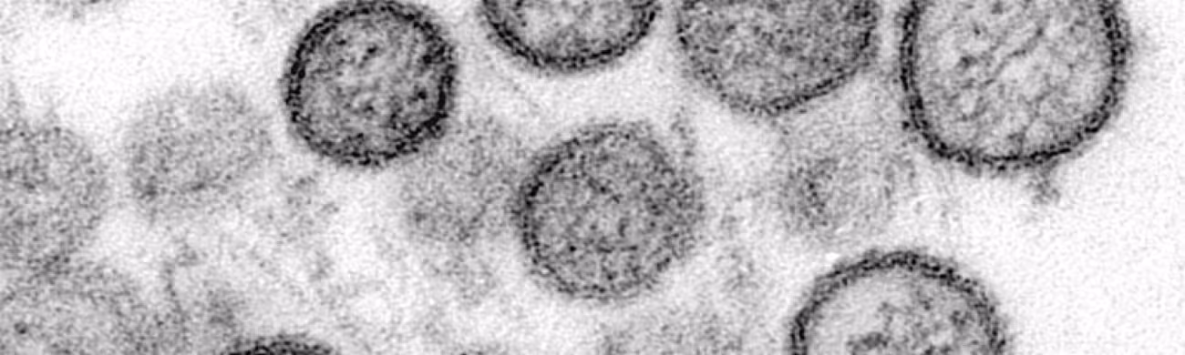Transmission electron microscope image of Sin Nombre viruses | CDC/ Cynthia Goldsmith, Luanne Elliott